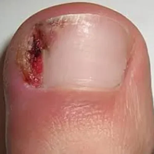 una-incarnada-clinica-cirugia-cosido